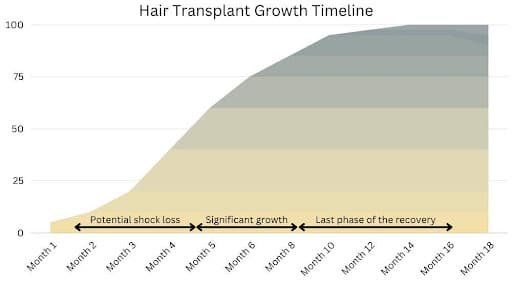 Vantage Hair Transplant in Turkey 1